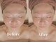 ル・ティアレの写真