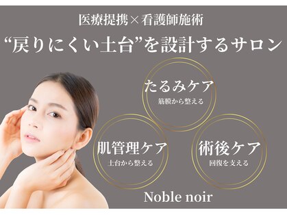 ノーブルノアール(Noble noir)の写真