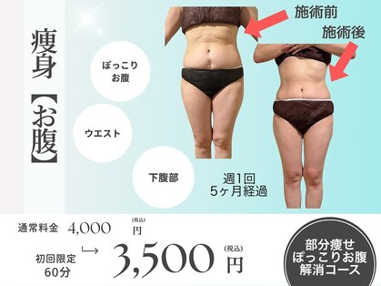 サロン ド ミコ(Salon de Mico)の写真