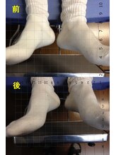 アトラス ストレートカイロプラクティック/足の長さのチェック