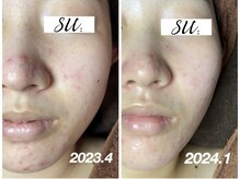 スウ(su:)/時間をかけて確実に変化！