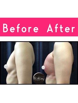 エルフラージュ 銀座店/姿勢改善バストケア