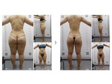 Nビューティー/最新エンダモロジーBODY