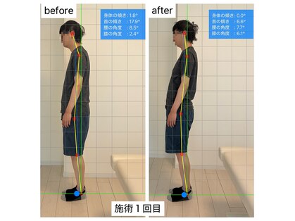 インフィニティ(INFINITY)の写真