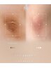 【最新黒ずみ除去/メラニンケア（ルメラ）】（ひじ)or(ひざ)