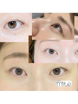 ミテ(mite.)/マツパ