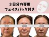 【 たるみ特化／頬コケなし】 サーマガン（エステ版サーマクール）中顔面短縮