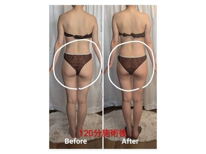 フィニシオンの写真