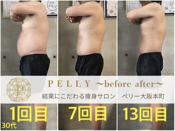 ペリー(PELLY)/男性30代　before after