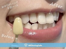ホワイトニングカフェ 立川店(WhiteningCafe)の雰囲気（ハイパワーなマシンで効果を実感♪）