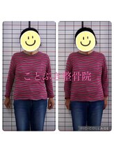 ことぶき整骨院/姿勢改善