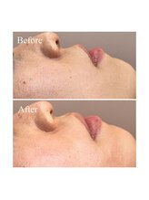 ホワイトワックス 京都四条烏丸(WHITE WAX)/お顔のくすみ解消♪