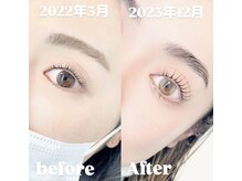 アリイ(ALII)/毛質改善/眉癖改善