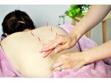 パル(PAL)の雰囲気（鍼灸には自律神経の調整も◎妊娠中でもうつ伏せで受けられます。）