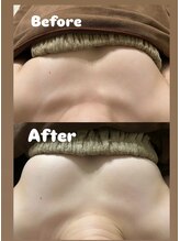 ベル/バストケア １回