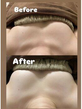 ベル/バストケア １回