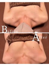 ロココ 水戸店(Rococo)/バストアップBefore &nbsp;After