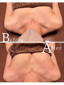 ロココ 水戸店(Rococo)/バストアップBefore After