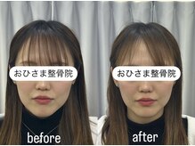 おひさま整骨院 整体院 姫路店/B＆A【姫路/小顔矯正/整体】