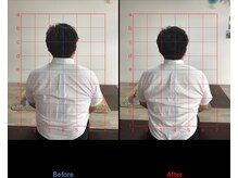 ストレチックス 近江八幡店/姿勢改善ビフォーアフター1回