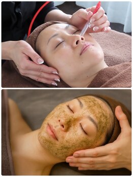 プレシャス(Precious)の写真/【韓国式ハーブピーリング】初回¥19,800→¥9.900《幹細胞保湿付き》