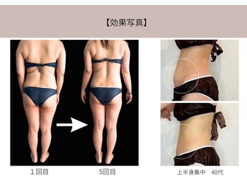 ミライ 福岡筑紫野店(mirai)/なりたいを叶えるボディメイク