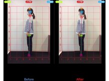 ケアハウス センター南(CARE HOUSE)/施術効果写真☆（before after）