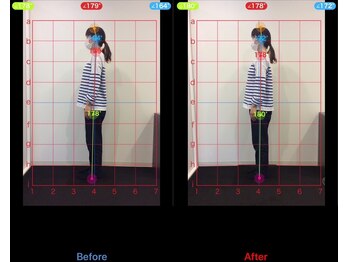 ケアハウス センター南(CARE HOUSE)/施術効果写真☆(before after)