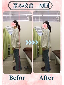 アミーゴ整体院/ビフォーアフター