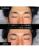 ユー 西船橋店(you)/ビフォーアフター写真