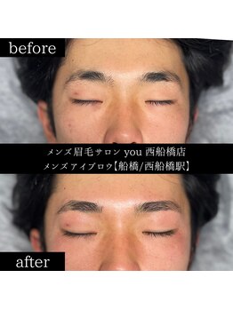 ユー 西船橋店(you)/ビフォーアフター写真