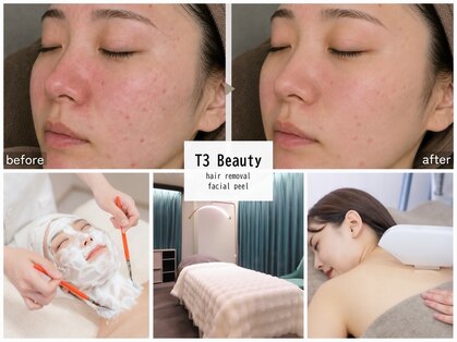 ティースリービューティー(T3Beauty)の写真