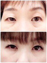 アイラッシュサロン ブラン イオンモール柏店(Eyelash Salon Blanc)/両目大きさ違う人に【柏店】