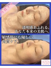 ハッピービューティーサロン じゆう(Happy Beauty Salon J∞YOU)/小顔ケア＆角質ケア