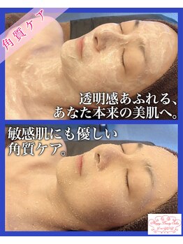 ハッピービューティーサロン じゆう(Happy Beauty Salon J∞YOU)/小顔ケア＆角質ケア