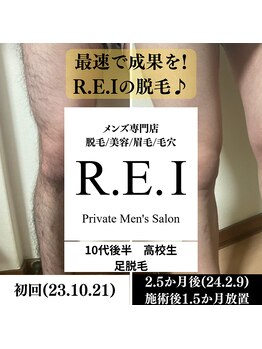 レイ(R.E.I)/足脱毛／10代後半／継続施術