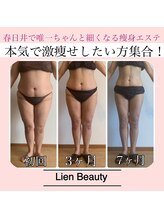 リアンビューティー(Lien Beauty)/マイナス30キロ達成！！