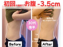 パリライム(parislime)/初回の施術だけで、お腹-3.5cm！