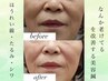 【初回お試し】なんか老けてる！を改善する美容鍼→¥3,500残2名