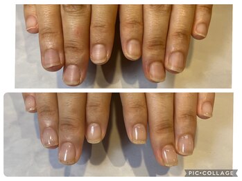 アンドネイル 海老名(&nail)/3週間の変化