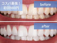 ボディアーキ 松山店(BODY ARCHI)
