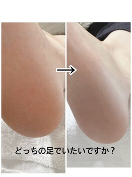 パールズ(PEARLS)/ホームケアとの連動で長持ち!