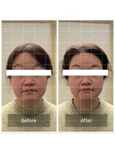 蒼月(aotsuki)/Before/After