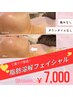 11月CP★韓国発！顔の脂肪撃退！脂肪分解フェイシャル 通常￥12,000→¥7,000