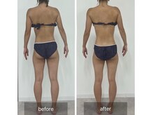 メロウゴールド(Mellow Gold)/筋膜リリースの手技で姿勢改善！