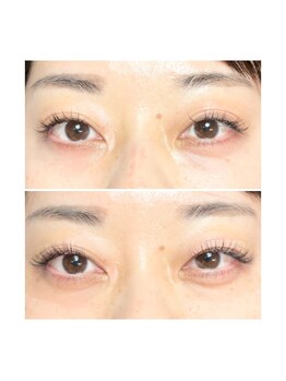 リュニック(L’unique)/リフトupラッシュ♪