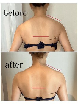 カレント(current)/よもぎ+筋膜《上半集中》¥9500