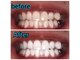 ホワイトニングビューティー 松戸店(Whitening Beauty)の写真