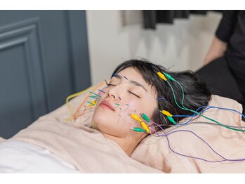 サリエ(S'allier)/美容鍼（通電）