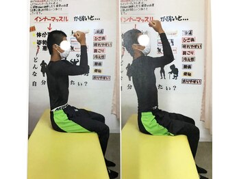 藤接骨院 焼津小川院/右肩、肘の痛みが改善